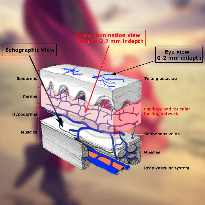 Epiderme